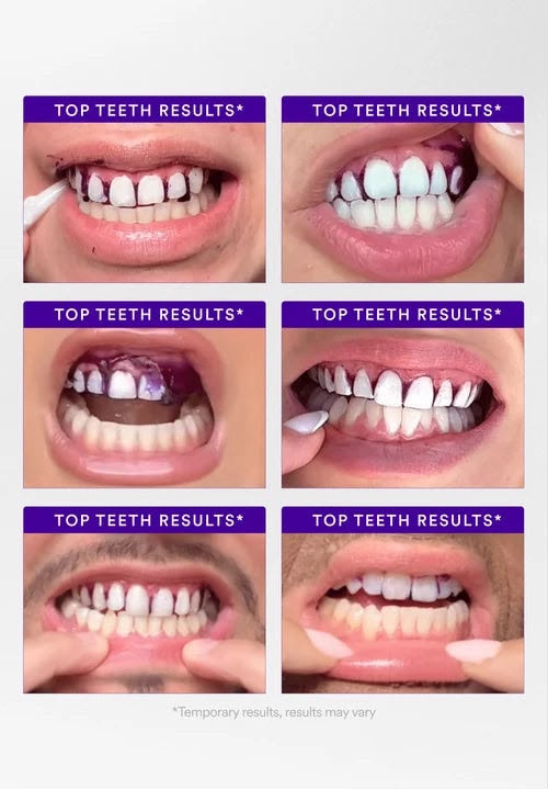 Purple Teeth Whitening Strip