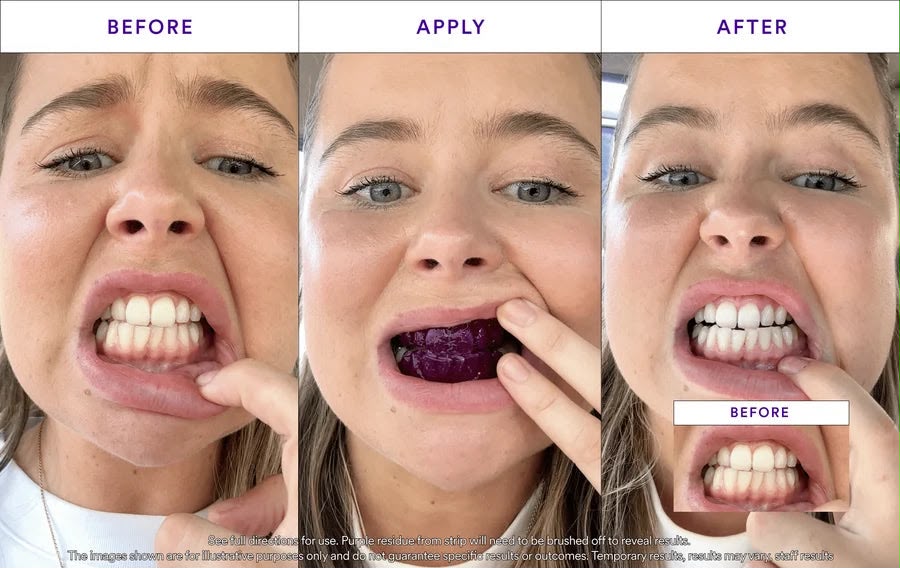 Purple Teeth Whitening Strip